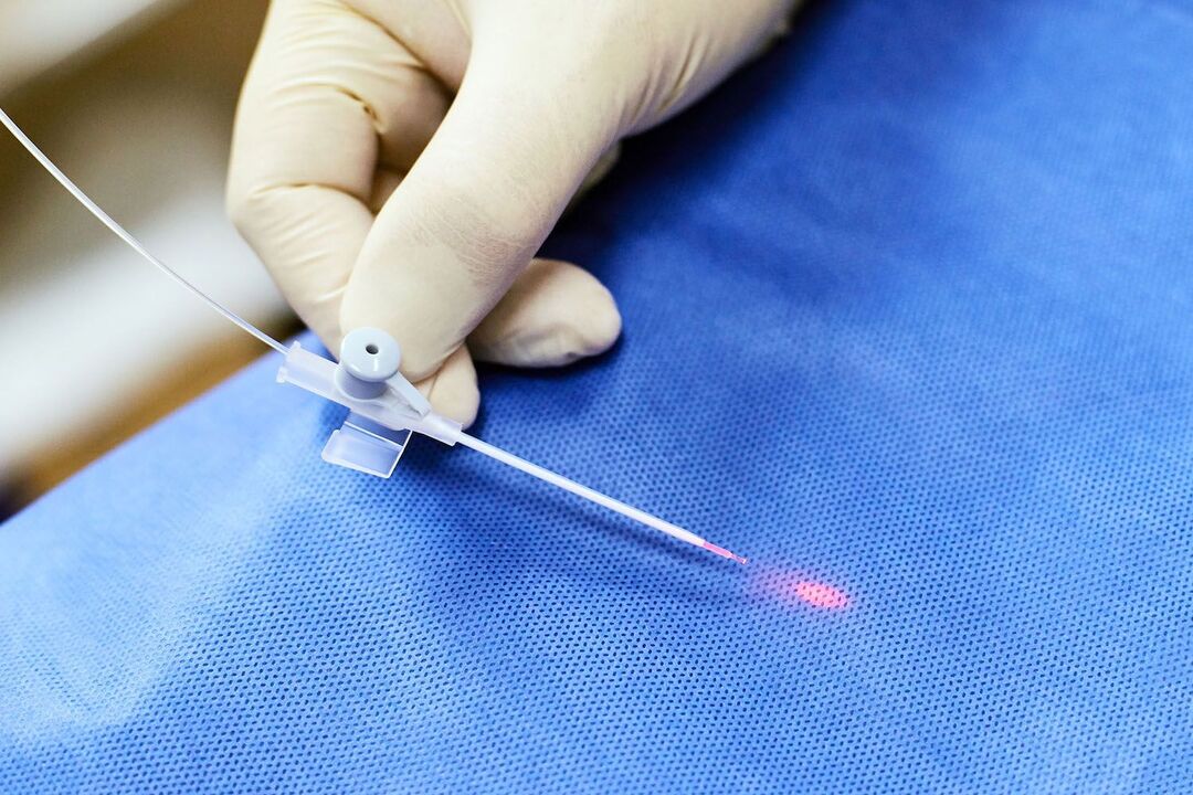 dispositivo transretal para tratamento da próstata